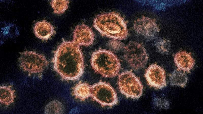 EU detecta primer caso de hantavirus, virus que afecta los pulmones